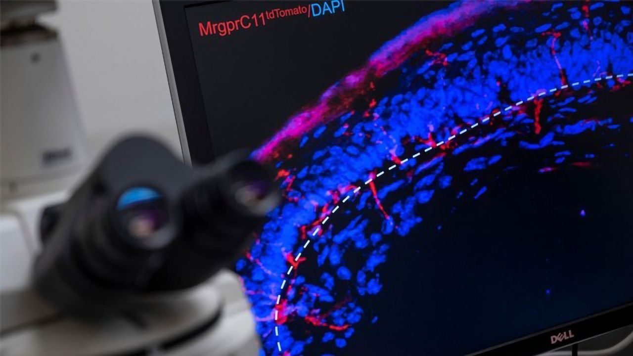Investigating Itch Mechanisms in Hairless Versus Hairy Skin