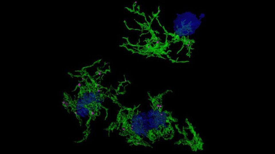 Gene Signatures Underlying Plaque-Eating Microglia Are Discovered content piece image