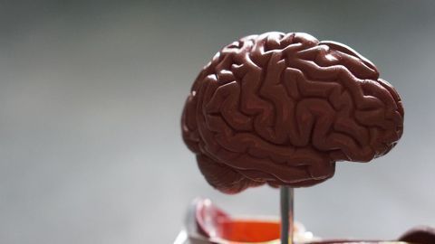 Simple Diagnostic Tool Predicts Risk of Alzheimer's