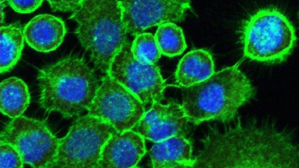 Fungi and Bacteria Can Activate Genes Linked to Head and Neck Cancer content piece image