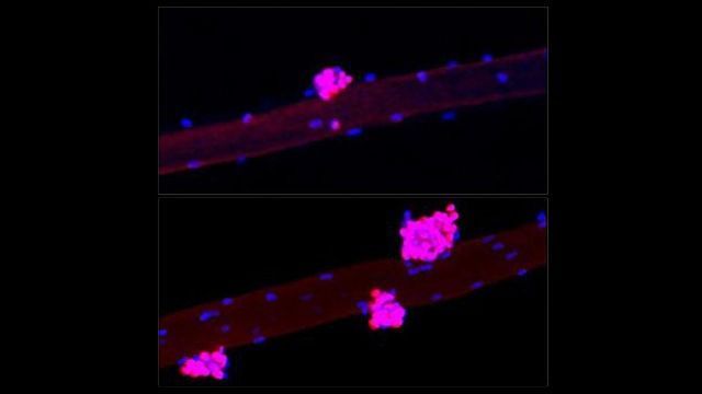 Photogenic Muscle Mechanisms Underlying Muscle Regeneration and Growth Revealed ...