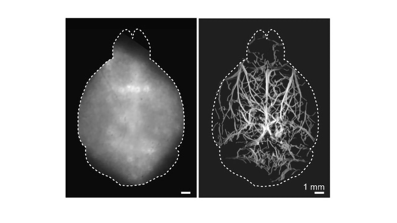New Technique Peers Deeper Into the Brain Than Ever Before