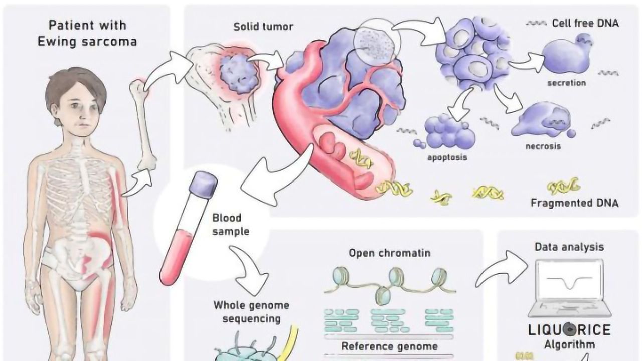 Blood Test Detects Childhood Tumors Based on Their Epigenetic Profile
