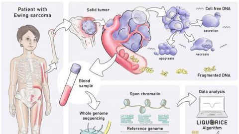 Blood Test Detects Childhood Tumors Based on Their Epigenetic Profile