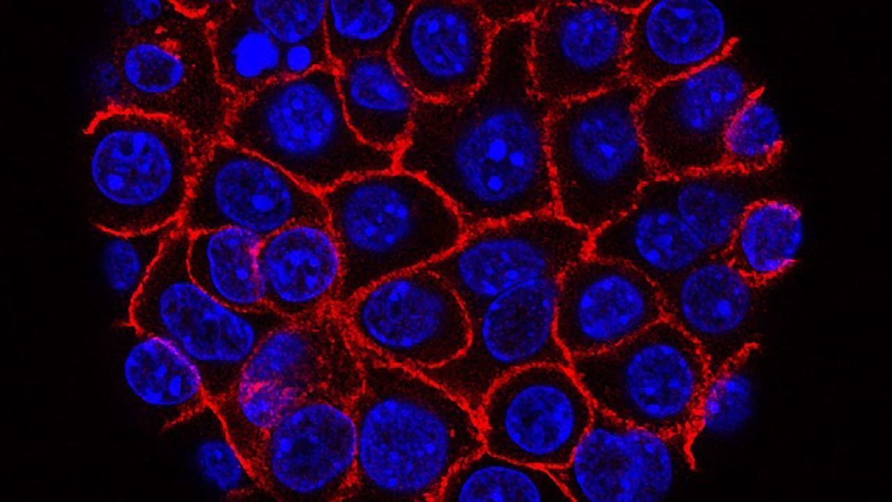 “Electronic Nose” Accurately Sniffs Out Cancer