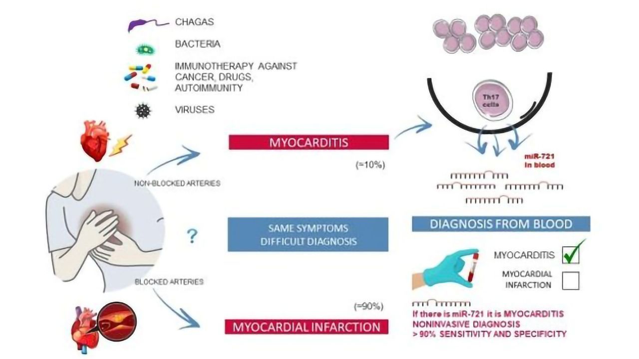 Blood Biomarker Distinguishes Between Myocarditis and Acute Myocardial Infarction