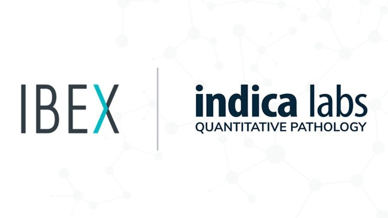 Indica Labs Partners With Ibex To Deliver AI-Powered Clinical Workflows