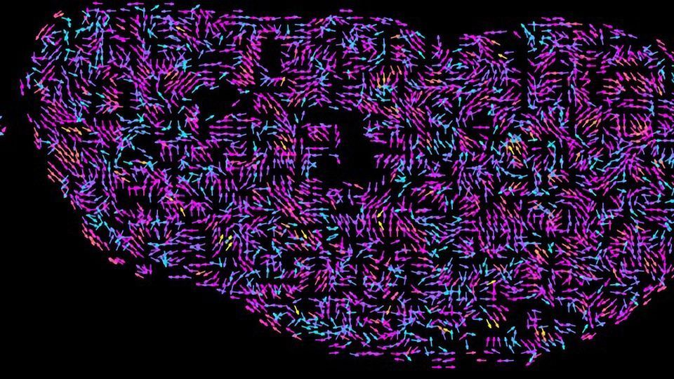 Human Genome Organization Relies on the Physics of Different States of Matter content piece image