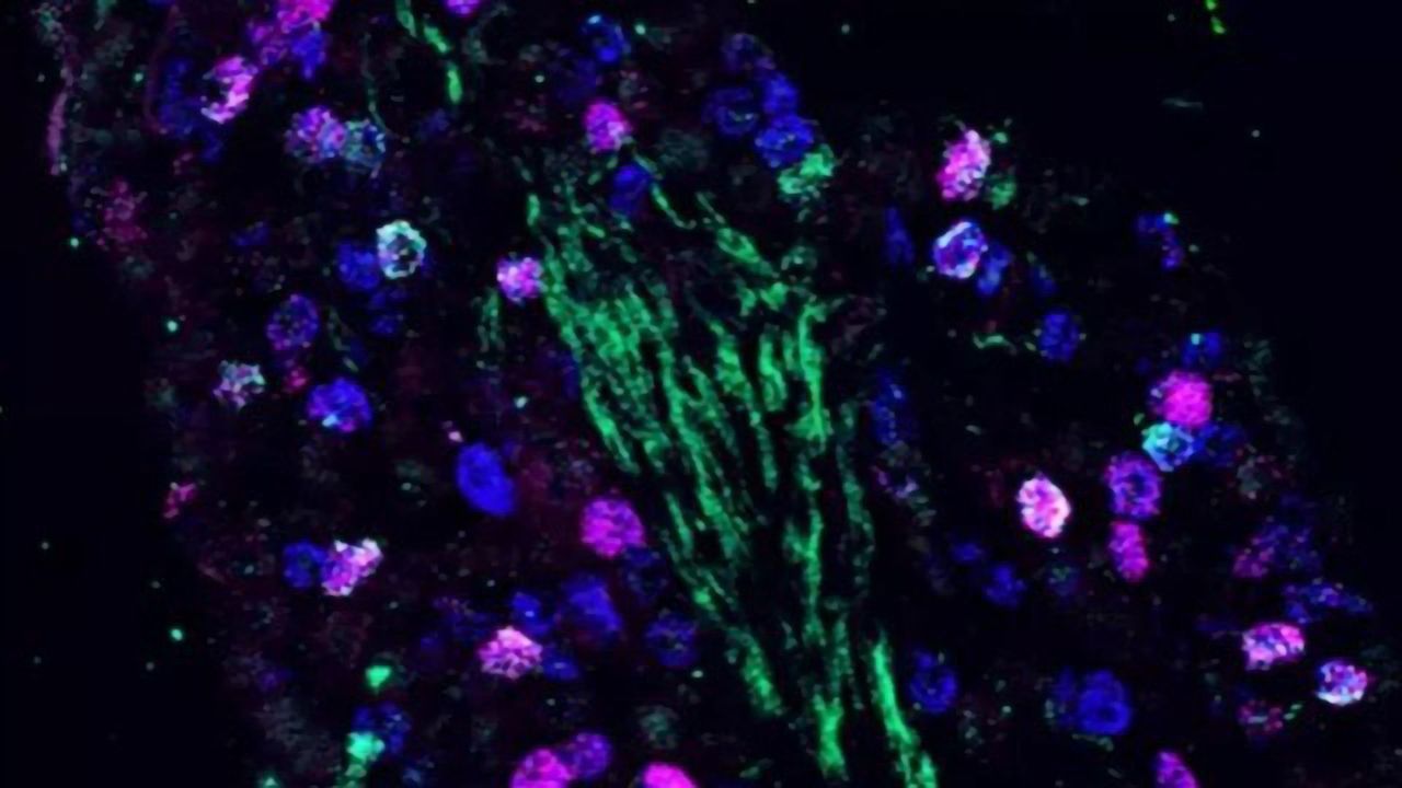 The Vagus Nerve's Control Center Helps the Brain Track What We Eat