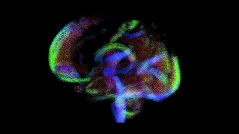 800 Baby Brain Scans Could Help Track Disease Development