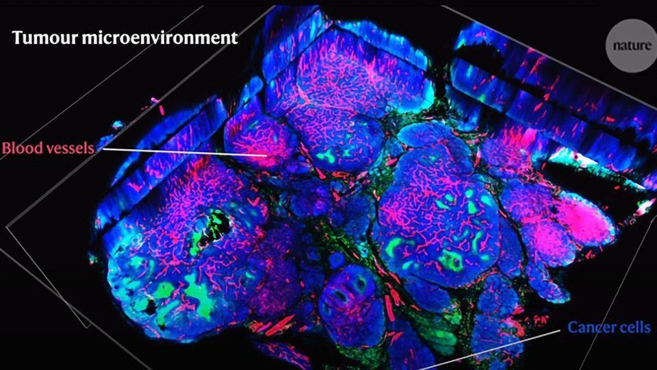 Cancer, Aging and the Importance of the Tumor Microenvironment content piece image