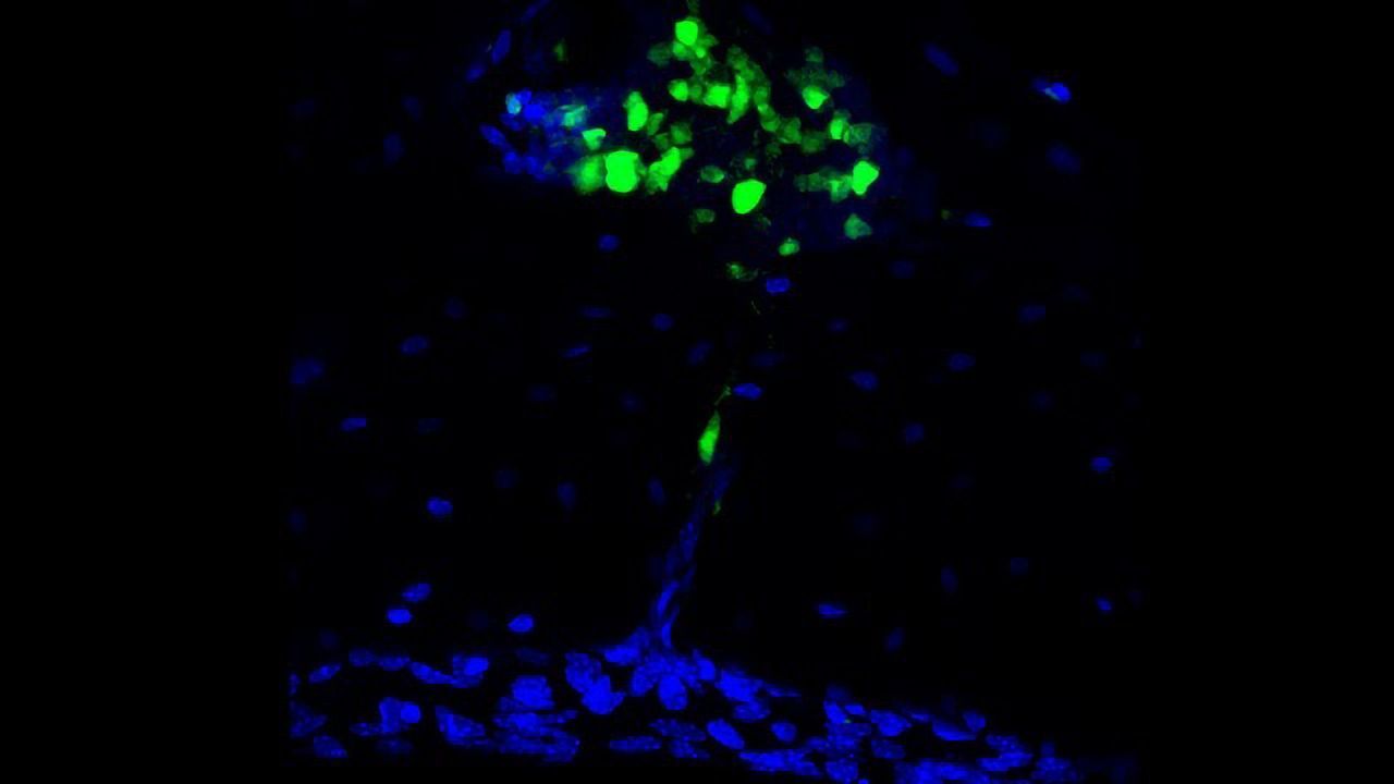 The Skull Is an Unexpected Reservoir for Brain Immunity