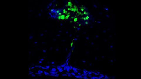 The Skull Is an Unexpected Reservoir for Brain Immunity
