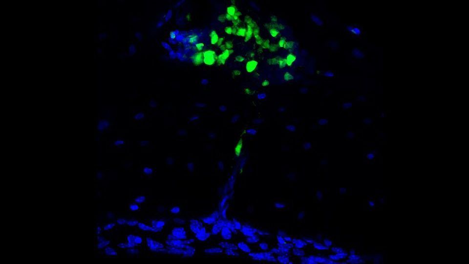 The Skull Is an Unexpected Reservoir for Brain Immunity content piece image