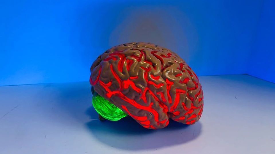 Computer Simulations of the Brain Predict Stroke Recovery content piece image