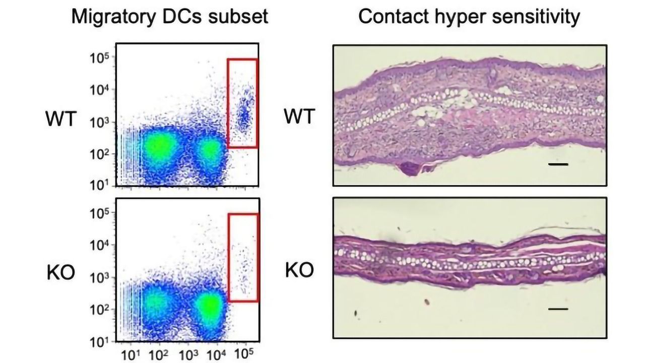 Molecular Mechanism of Immune Cell Migration Revealed