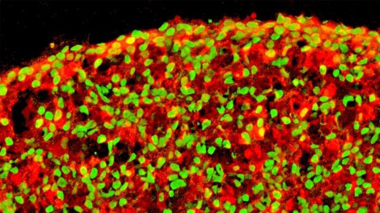 New Method Optimizes Production of Insulin-Producing Cells