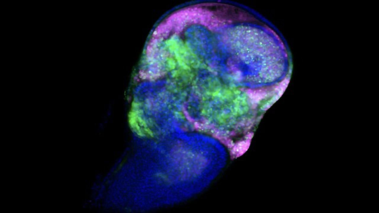 Cell Death and Proliferation
