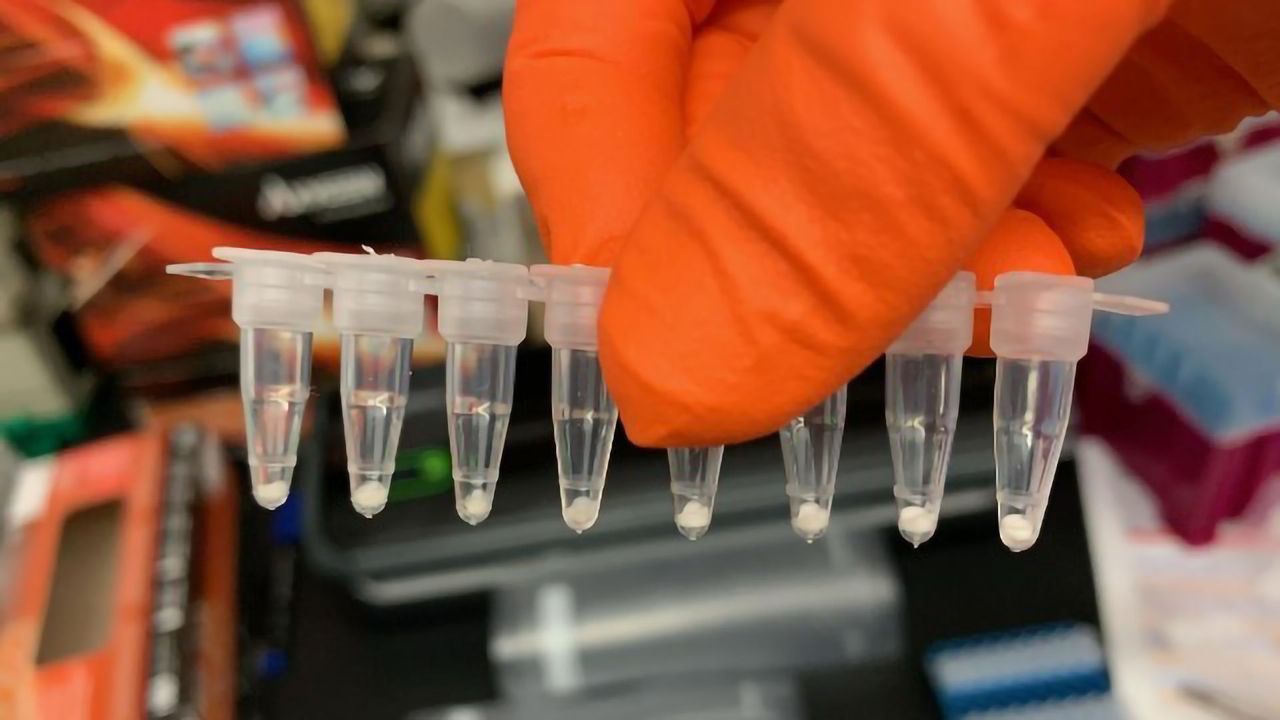 COVID-19 PCR Tests Can Be Freeze Dried