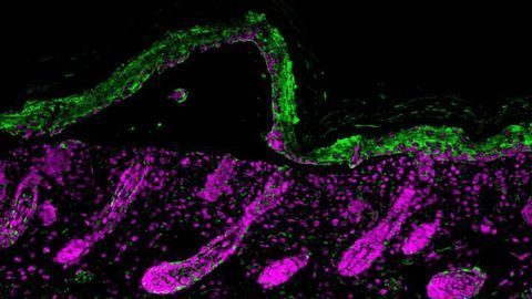 Hair Follicles Heal Blisters at Personal Cost