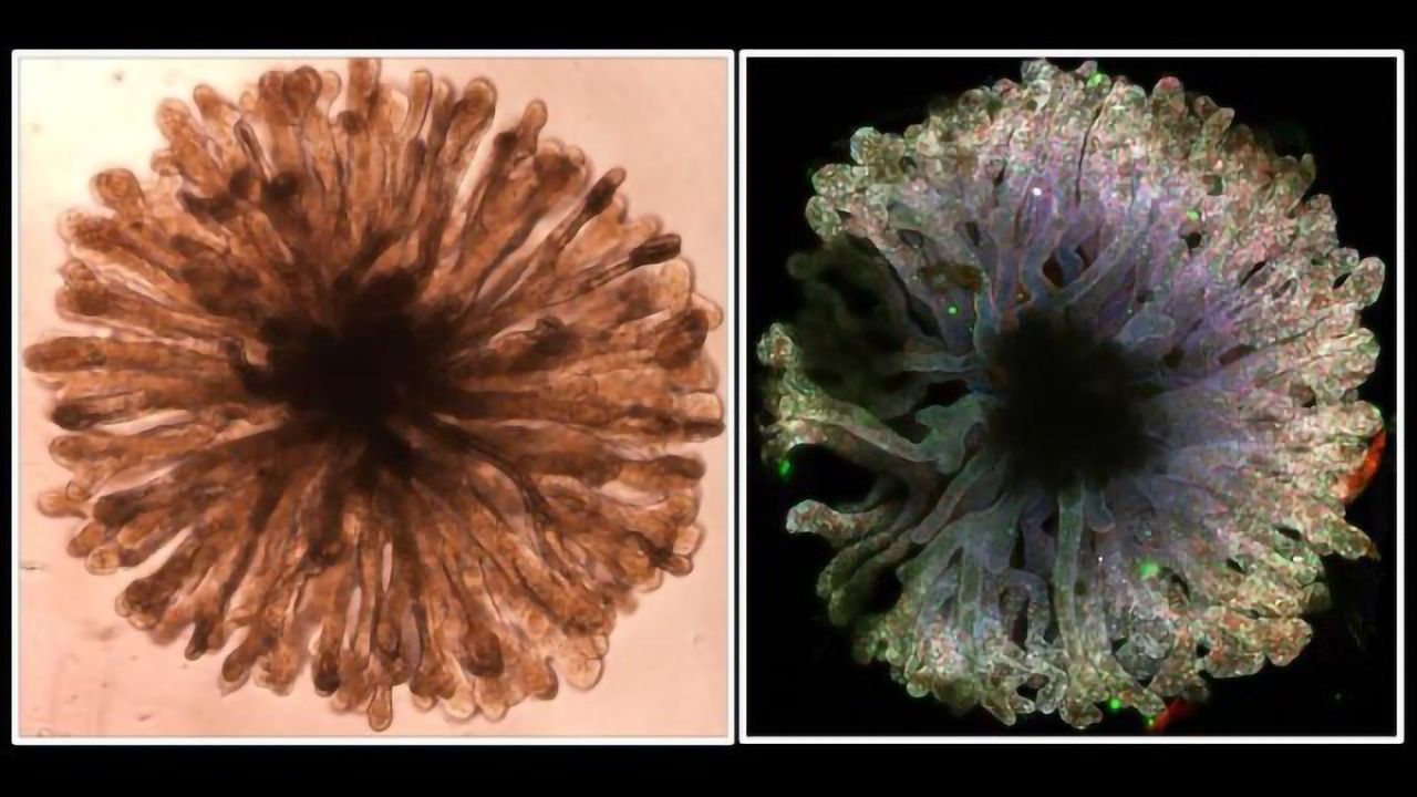 New Type of Kidney Organoid Developed