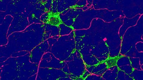 New Types of Glial Cell Identified Could Help Repair the Brain