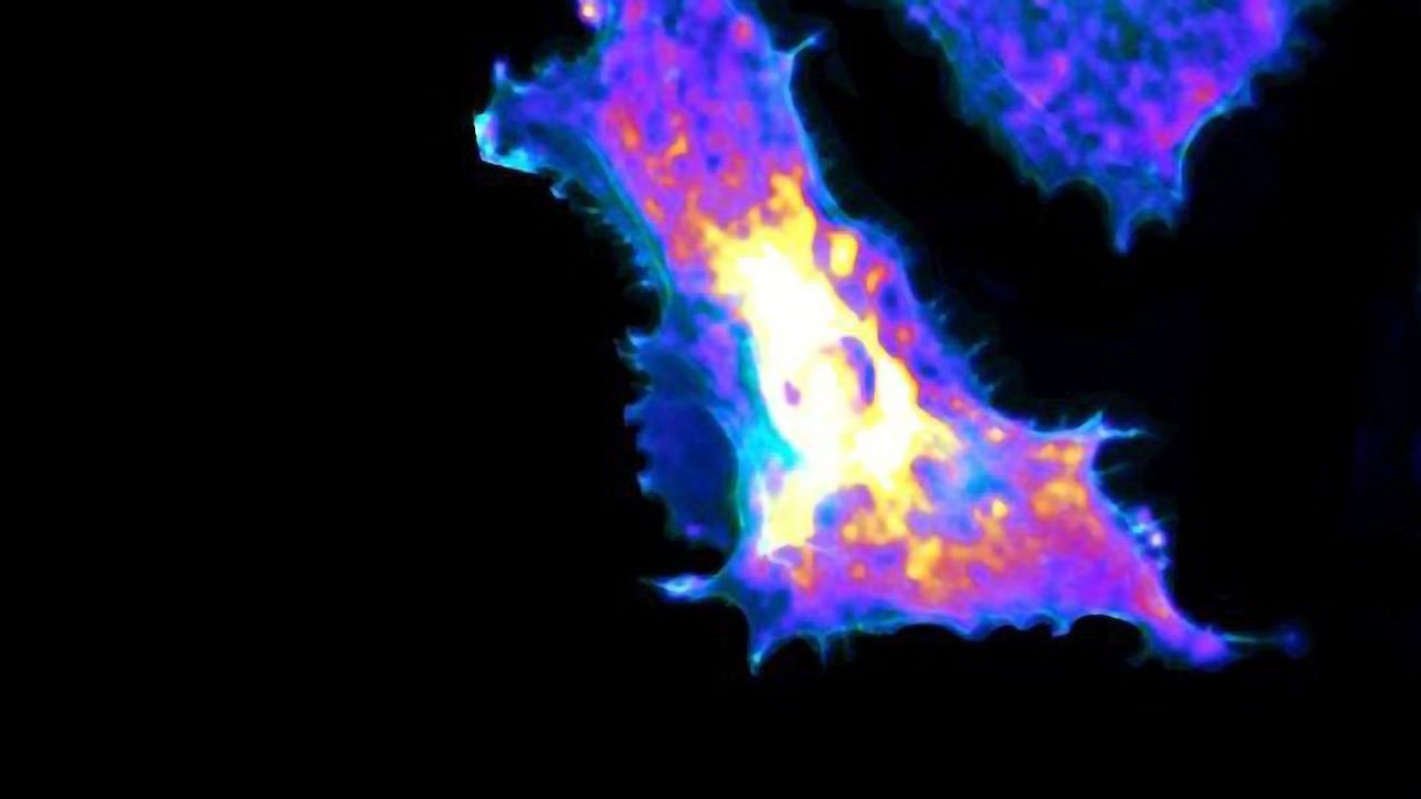 Metabolic Processes Visualized at the Single-Cell Level