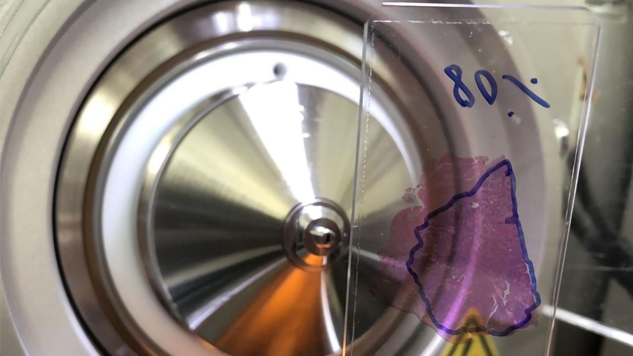 Probing Deep Into Tumor Tissues