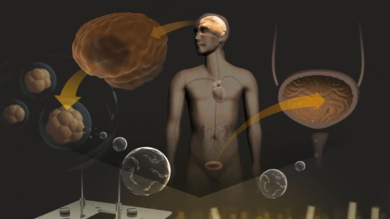 Brain Tumors Could Be Detected Earlier by a Simple Urine Test