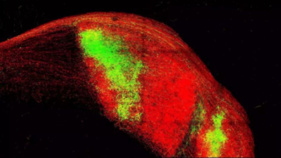 Eye on the Prize: Neurons Choose a Single Eye To Connect Strongly With content piece image