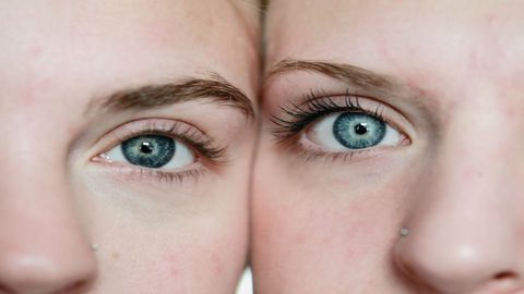 Twin Study Reveals Common Genetic Risk Factors for PTSD and Migraine
