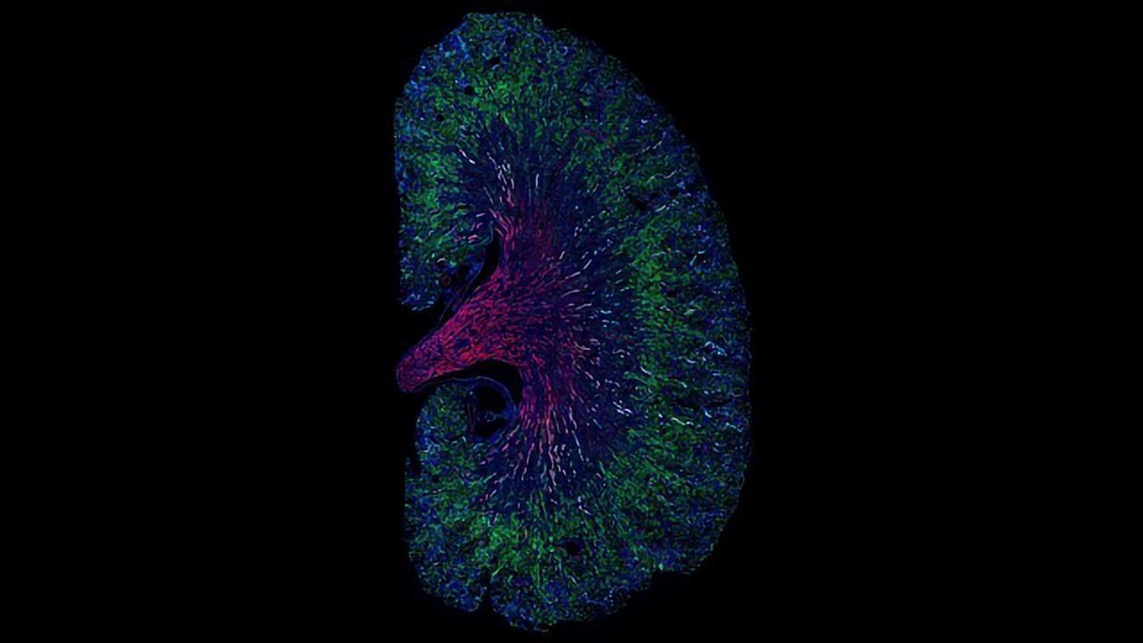 Proximal Tubule Cells Can Help or Hinder Kidney Repair