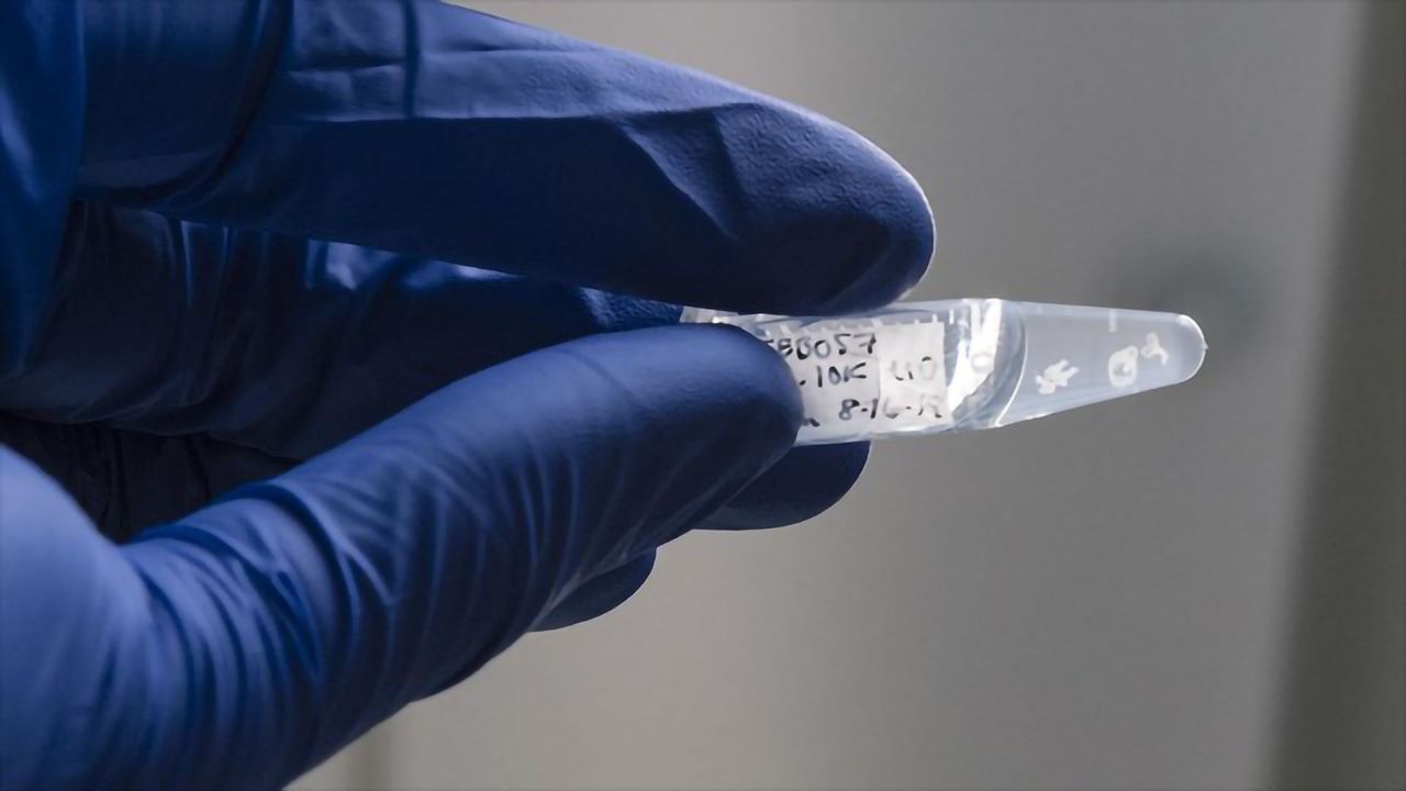 Heads or Tails? How Developing Spinal Cords Choose a Direction