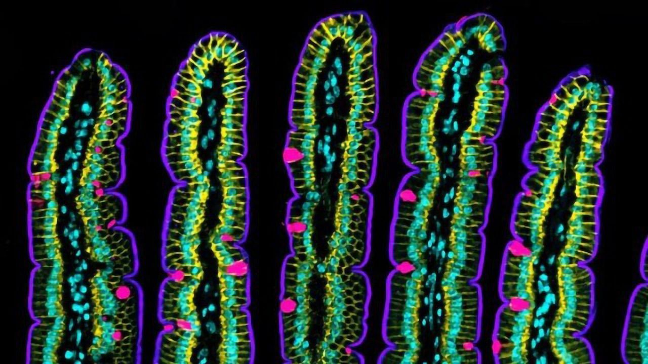 Researchers Uncover How the Intestinal Epithelium Folds and Moves