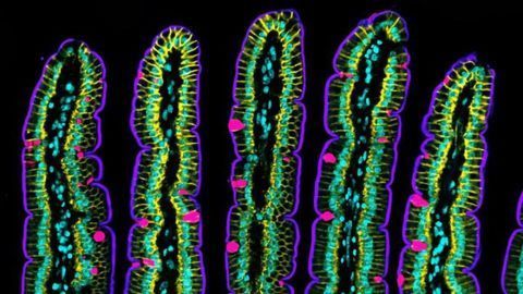Researchers Uncover How the Intestinal Epithelium Folds and Moves
