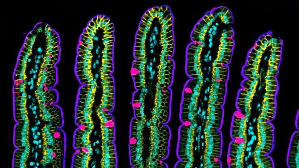 Researchers Uncover How the Intestinal Epithelium Folds and Moves content piece image