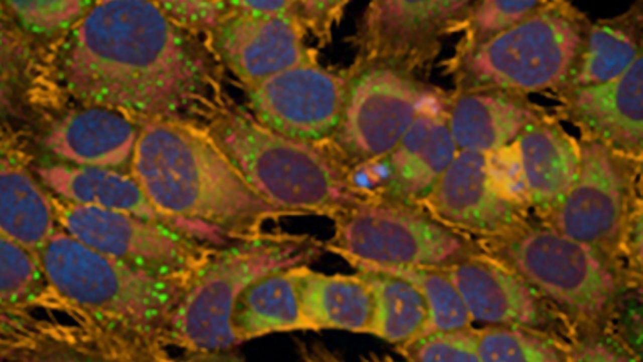 PerkinElmer Supports JUMP-CP Consortium