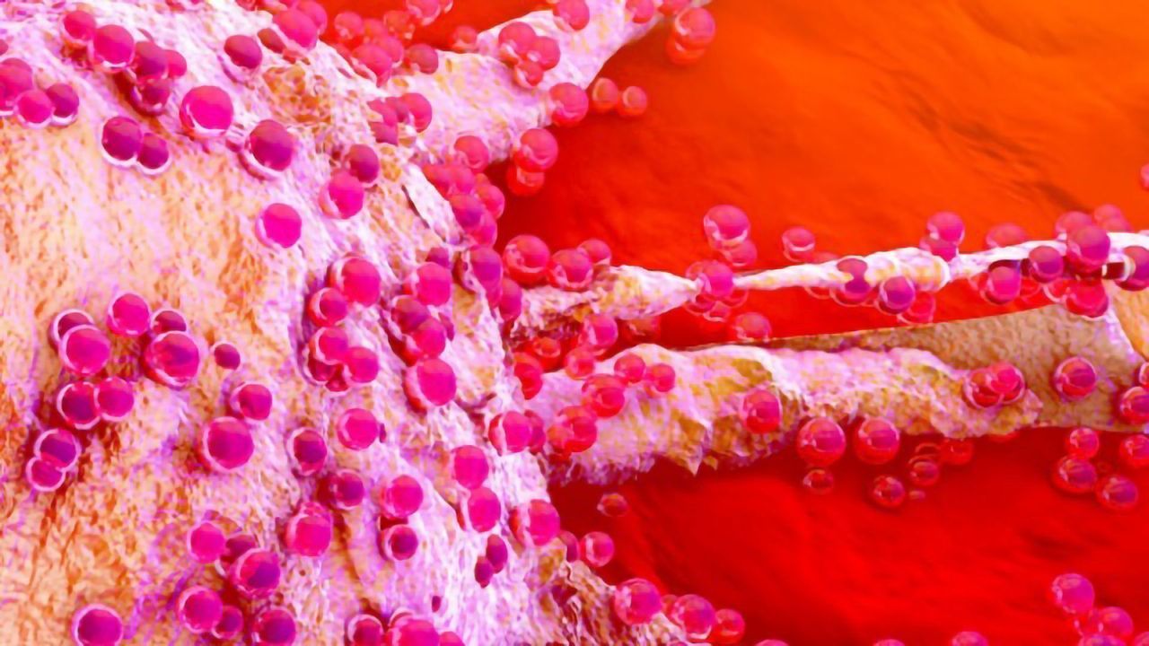 Personalized Medicine – <i>In Vitro</i> Drug Testing on Primary Cancer Cells