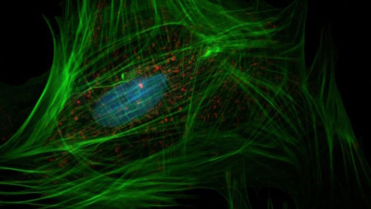 Connective Tissue Protein Balances Immune Response to Bacterial Infection