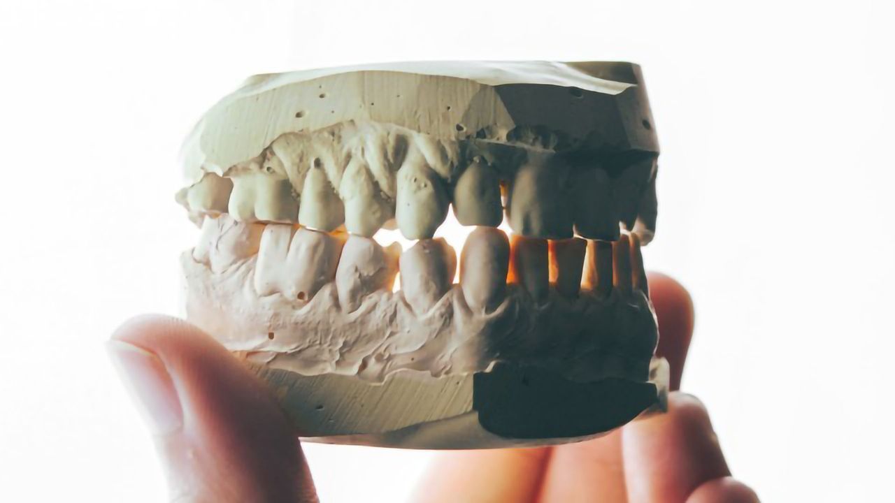 People With Removed Wisdom Teeth Had a Better Sense of Taste Decades Later