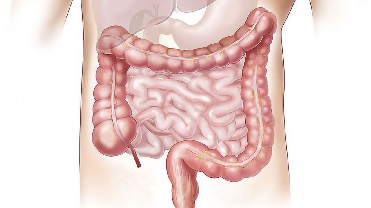 Stool Protein Markers of Intestinal Diseases Discovered