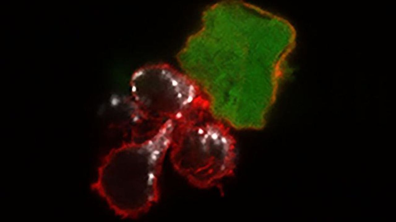 Cell-Based Immunotherapy May Be Effective Against Melanoma