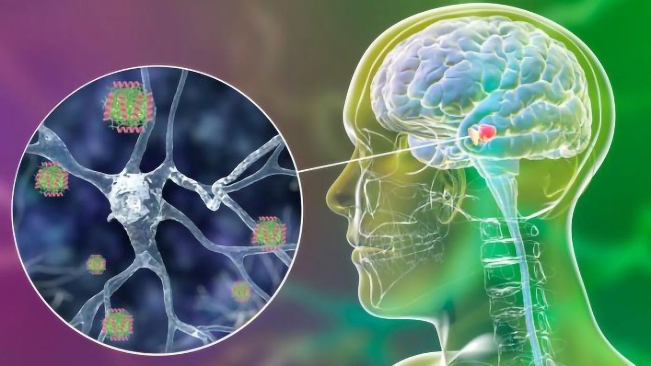 Human Peptide Found in the Brain Blocks Parkinson’s Disease Protein