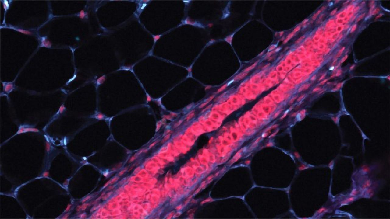 Mammary Tissue Cells