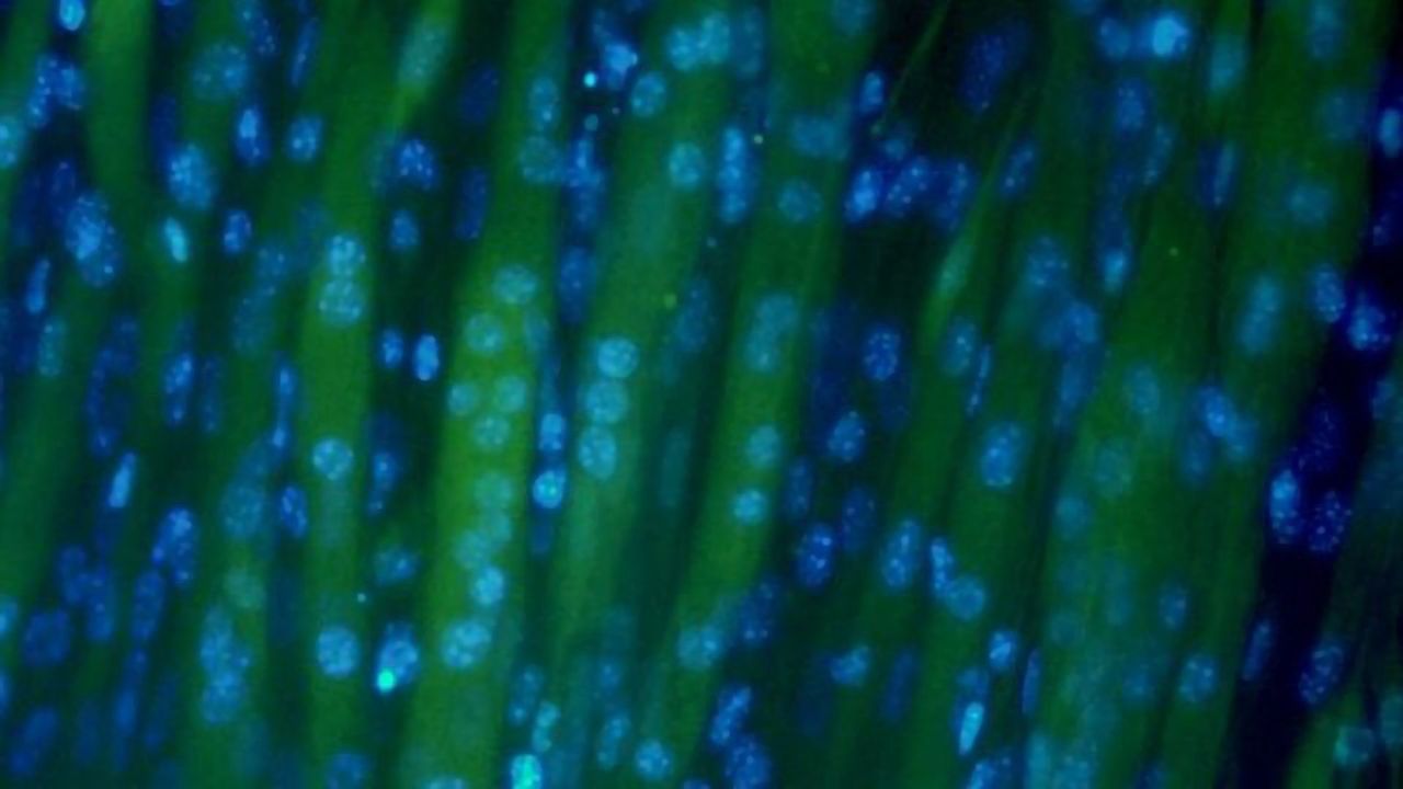 Cultured Meat Replaces Animals With Grass
