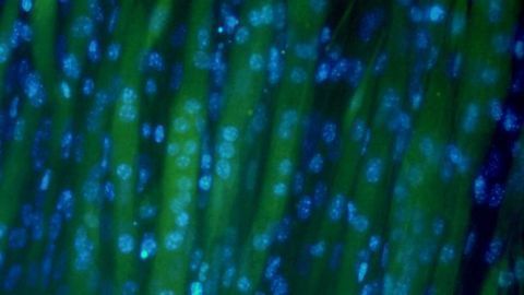 Cultured Meat Replaces Animals With Grass