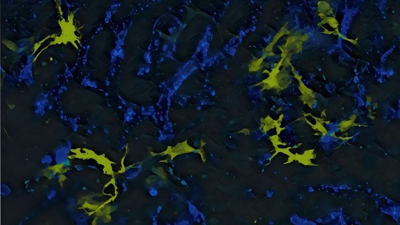 Developing Cancer Immunotherapies With Fewer Side Effects
