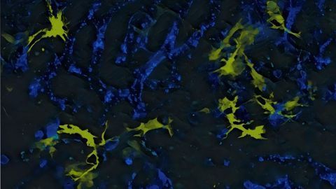 Developing Cancer Immunotherapies With Fewer Side Effects