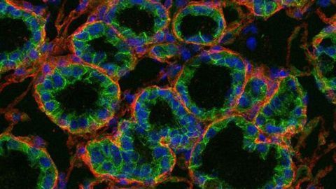 Extracellular Matrix Guides Growth and Function of Epithelial Cells