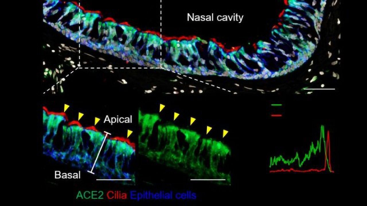 SARS-CoV-2 Replication Targets Nasal Ciliated Cells Early in COVID-19 Infection